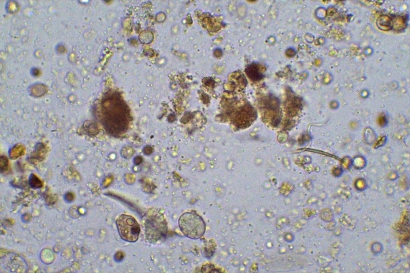 healthy soil in bucket